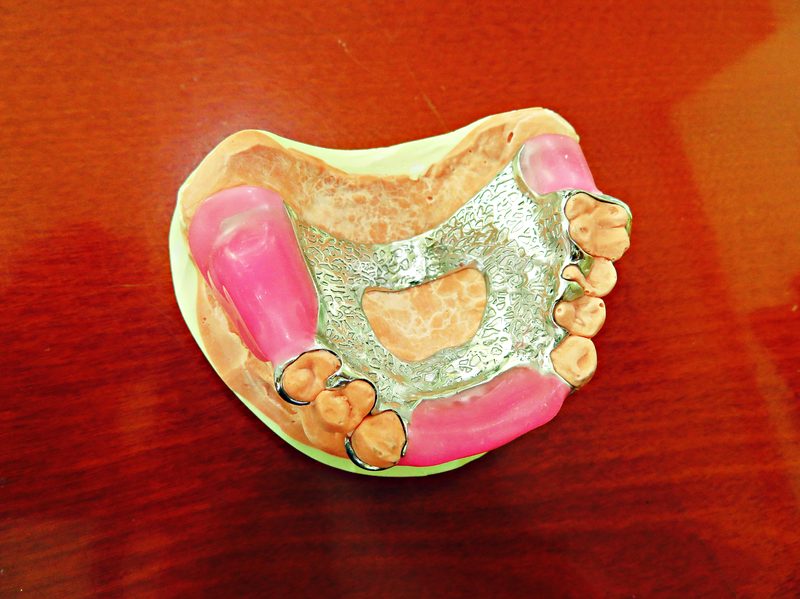 CoCr partial denture with bite block